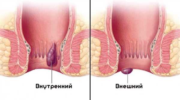 Факторы