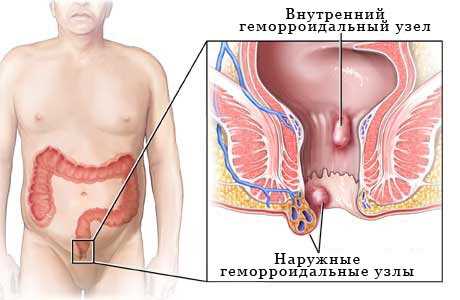 Медикаментозное