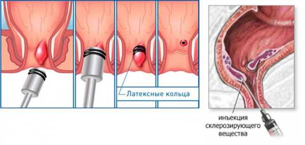 Сколько