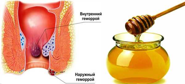 Рецепты