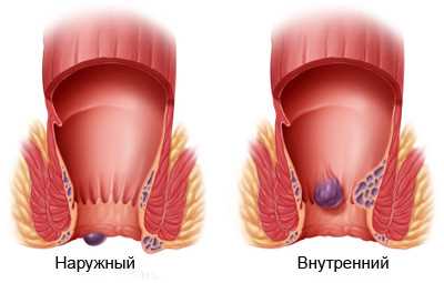 Способы