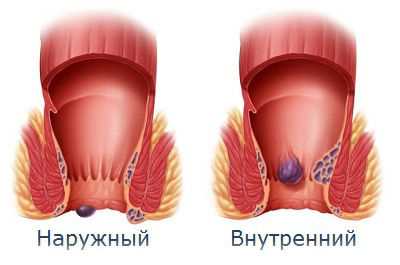 Польза