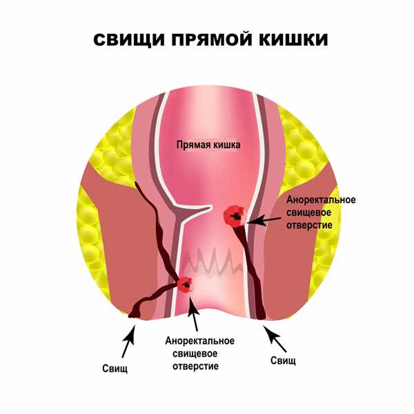 Преимущества