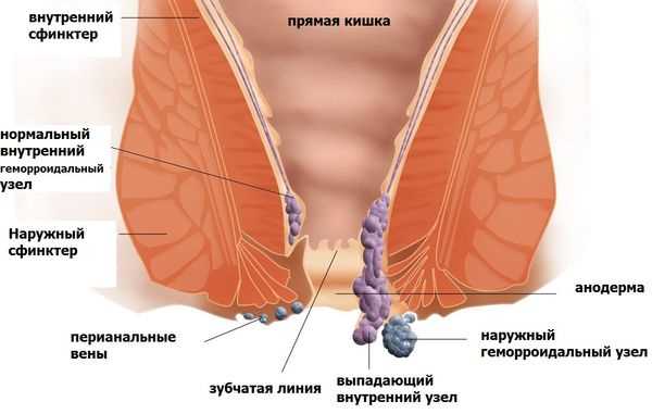 Кровотечение