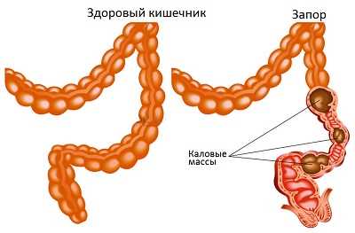 Диагноз