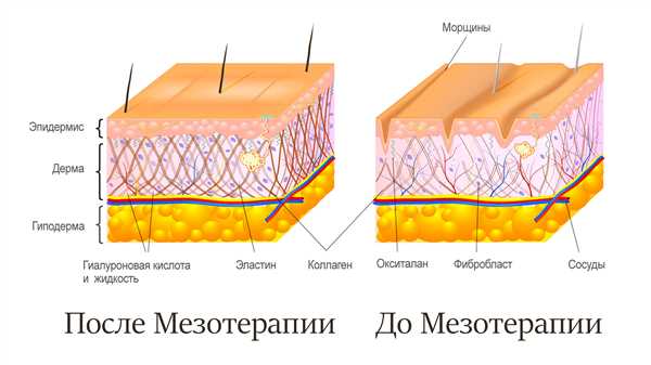 Риски