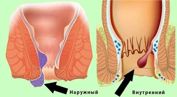 Причины