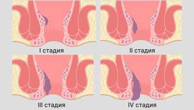 Оперативное