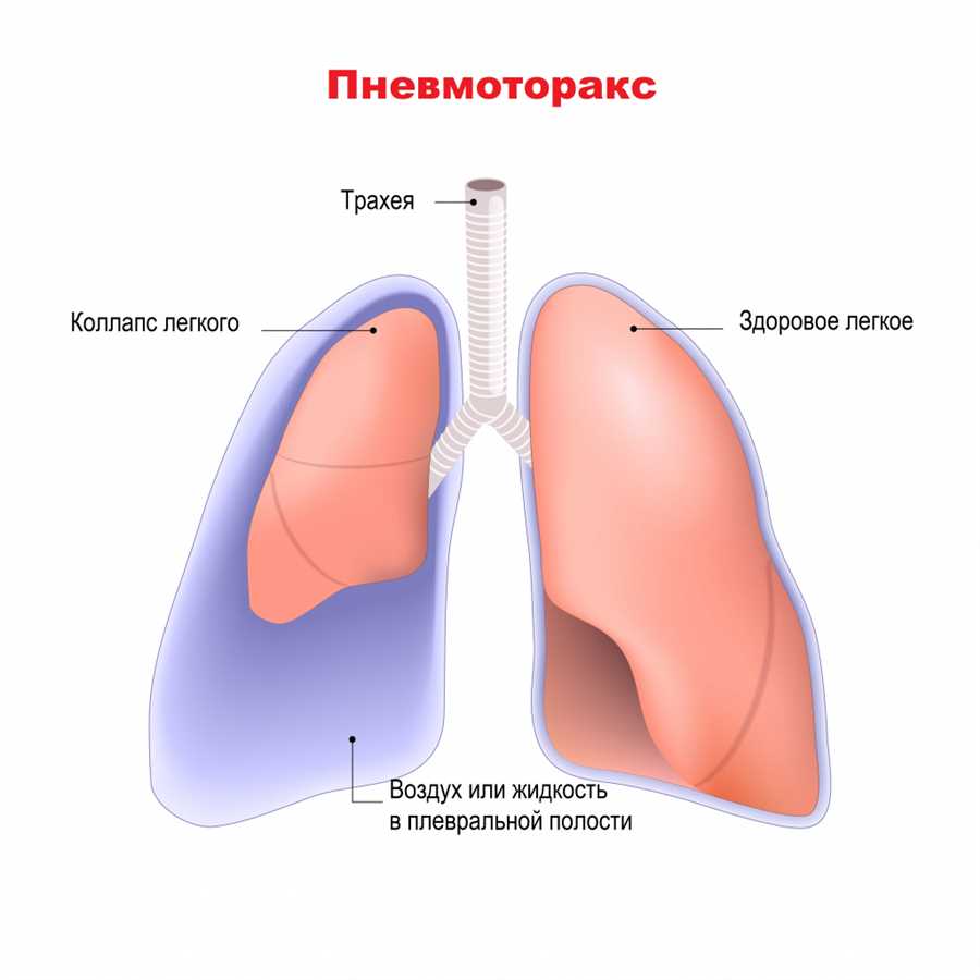 Почему