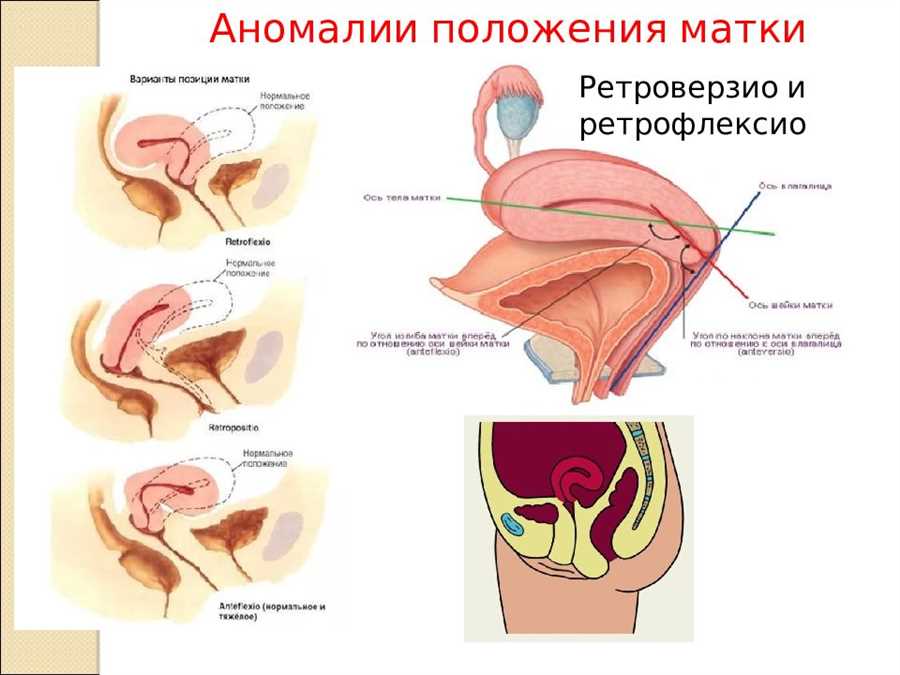 Последствия