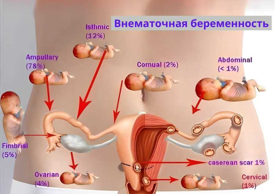 Профилактика