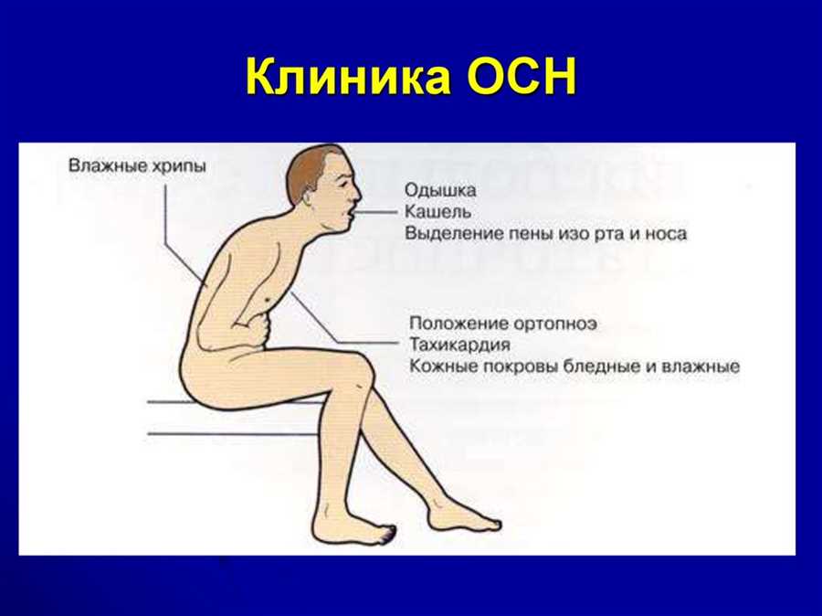 Осложнения