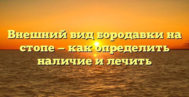 Внешний вид бородавки на стопе — как определить наличие и лечить