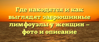 Где находятся и как выглядят забрюшинные лимфоузлы у женщин — фото и описание