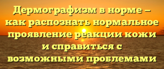 Дермографизм в норме — как распознать нормальное проявление реакции кожи и справиться с возможными проблемами