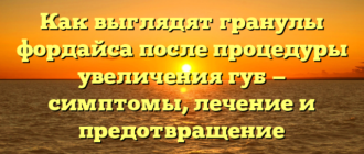 Как выглядят гранулы фордайса после процедуры увеличения губ — симптомы, лечение и предотвращение