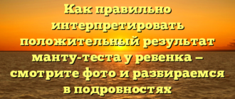 Как правильно интерпретировать положительный результат манту-теста у ребенка — смотрите фото и разбираемся в подробностях