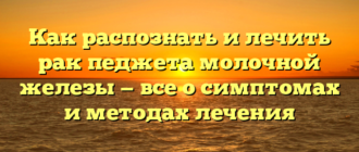 Как распознать и лечить рак педжета молочной железы — все о симптомах и методах лечения