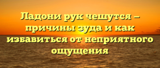 Ладони рук чешутся — причины зуда и как избавиться от неприятного ощущения