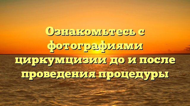 Ознакомьтесь с фотографиями циркумцизии до и после проведения процедуры