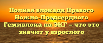 Полная блокада Правого Ножно-Предсердного Гемиблока на ЭКГ — что это значит у взрослого