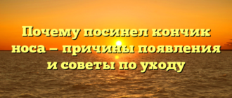 Почему посинел кончик носа — причины появления и советы по уходу