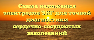 Схема наложения электродов ЭКГ для точной диагностики сердечно-сосудистых заболеваний