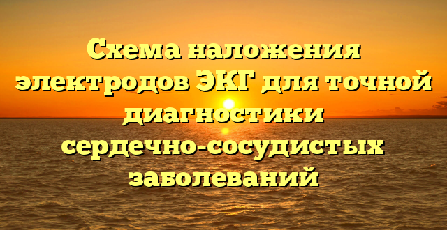 Схема наложения электродов ЭКГ для точной диагностики сердечно-сосудистых заболеваний