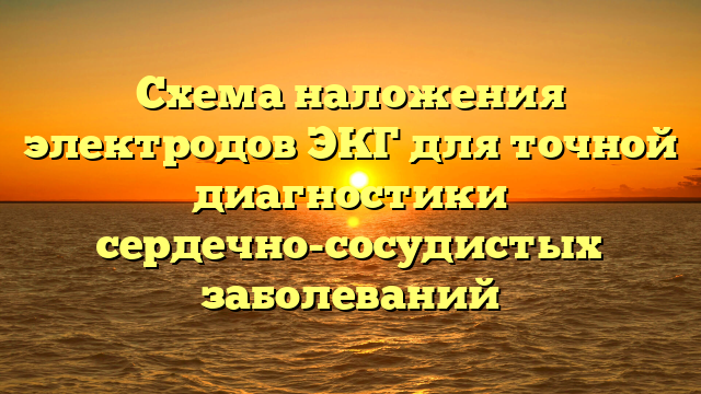 Схема наложения электродов ЭКГ для точной диагностики сердечно-сосудистых заболеваний