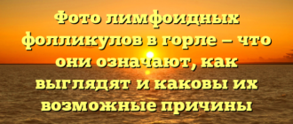 Фото лимфоидных фолликулов в горле — что они означают, как выглядят и каковы их возможные причины